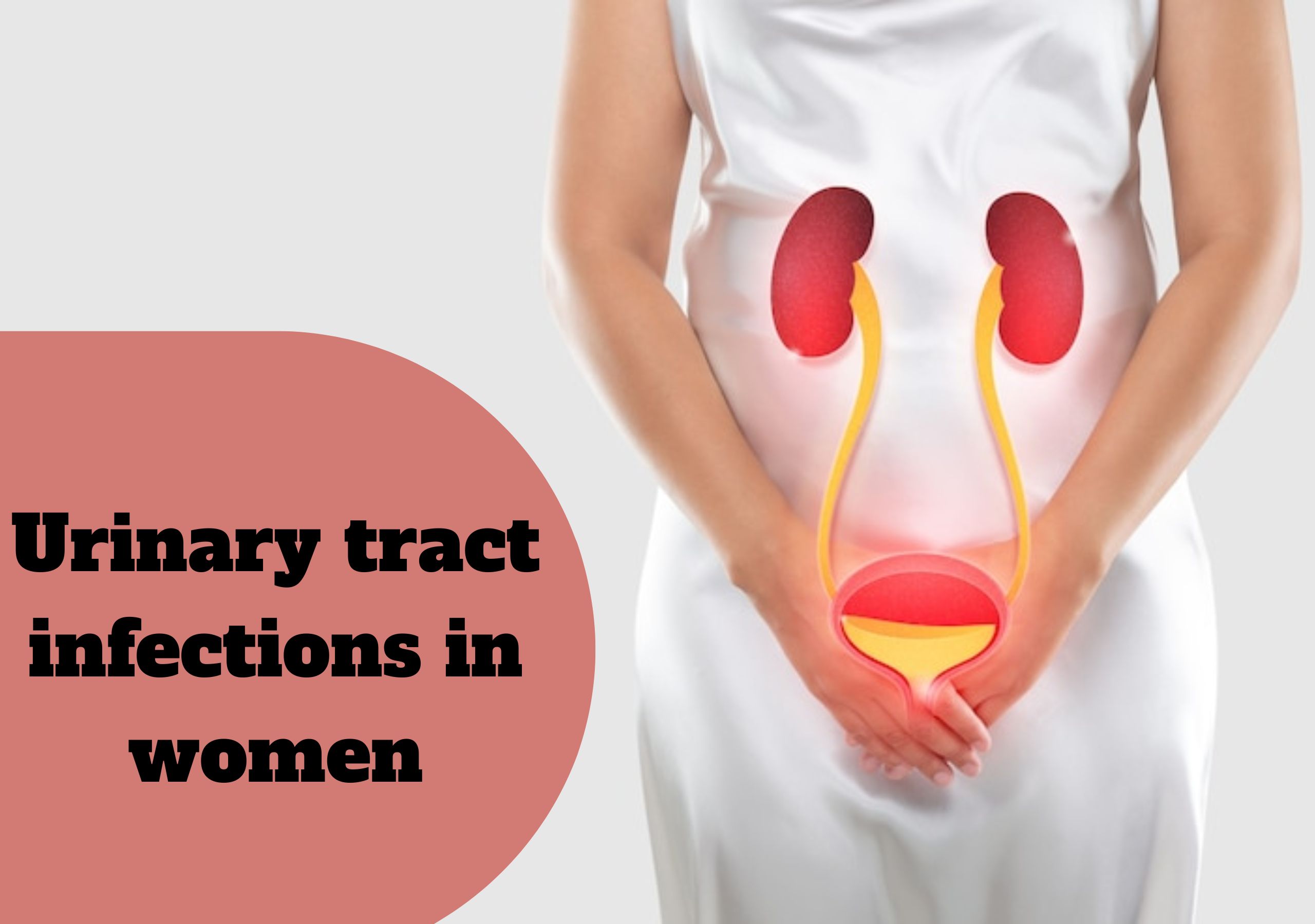 UNDERSTANDING AND PREVENTING UTI (URINARY TRACT INFECTIONS) IN WOMEN